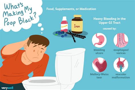 poop ebony|Black stool: Causes and when to see a doctor .